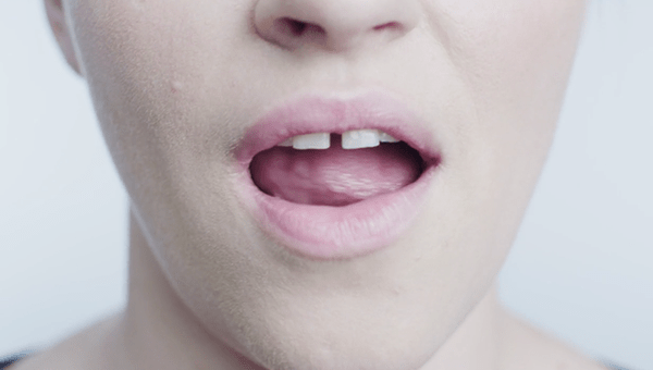 The Beauty Of&nbsp;Imperfection